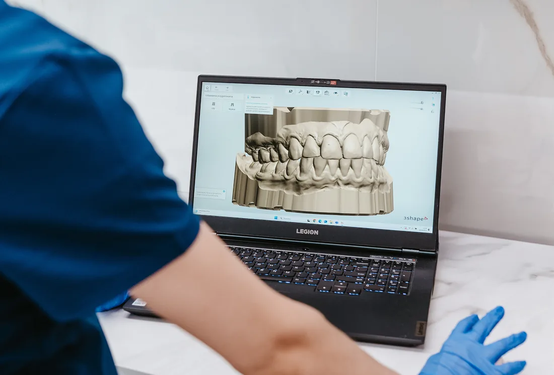 Higienistka Kazimierczak Clinic ogląda skan 3D zębów na laptopie
