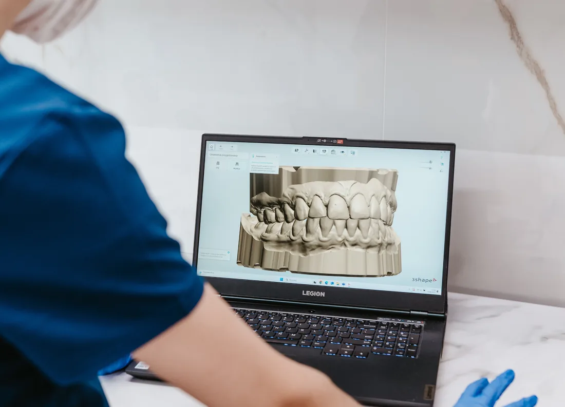 Skan 3D zębów na ekranie laptopa w gabinecie Kazimierczak Clinic